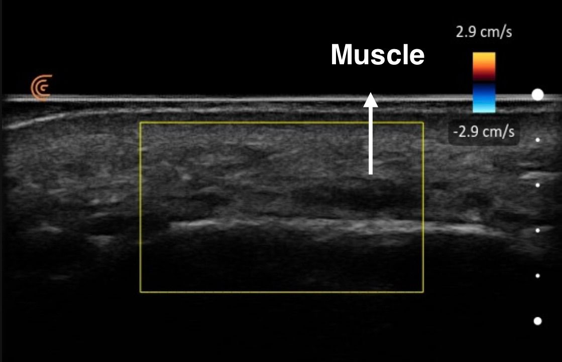 Ultrasound image