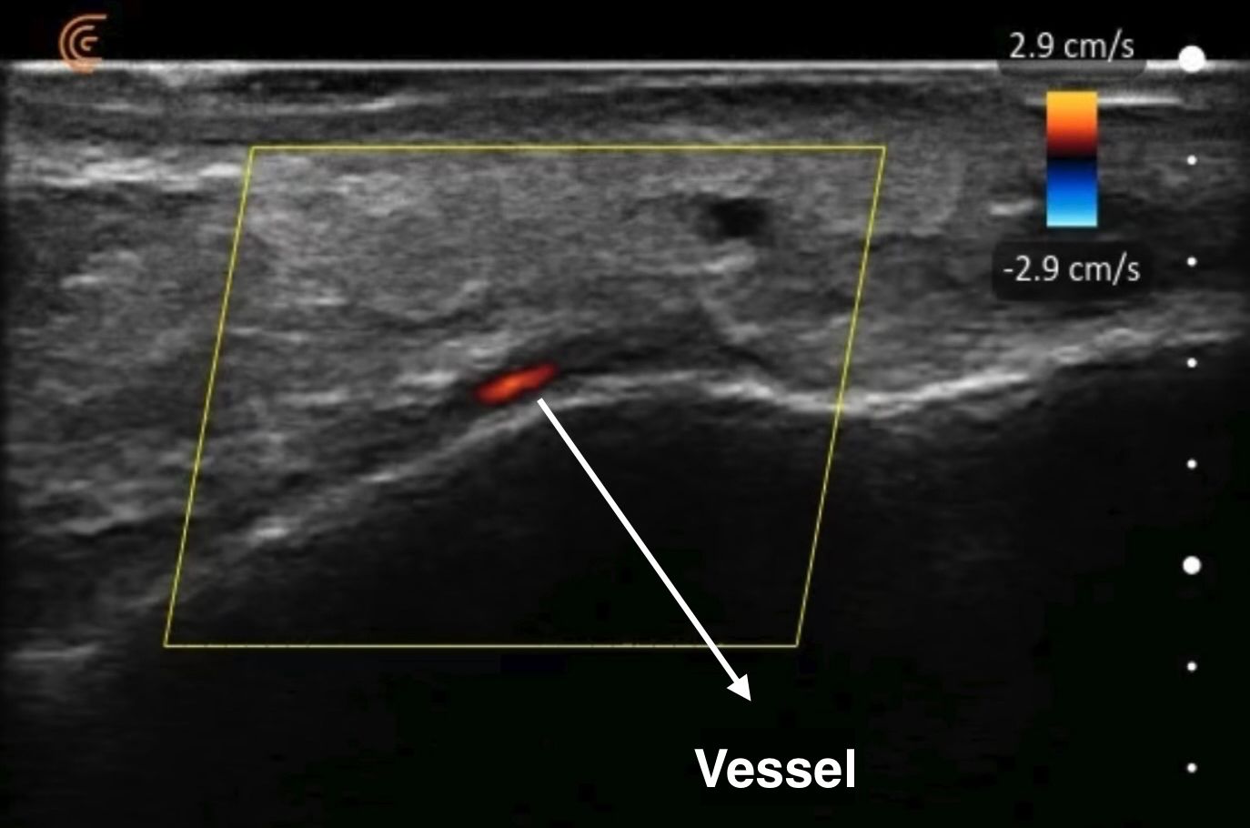 Ultrasound image